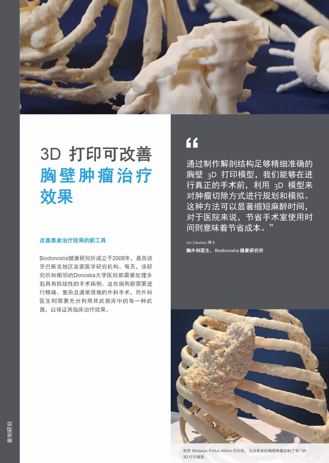 3D打印可改善胸壁腫瘤治療效果